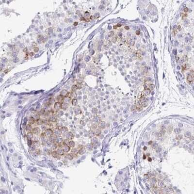 Immunohistochemistry-Paraffin DPEP3 Antibody - BSA Free
