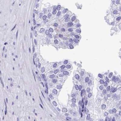 Immunohistochemistry-Paraffin DPEP3 Antibody - BSA Free