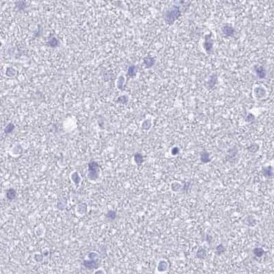 Immunohistochemistry-Paraffin DPEP3 Antibody - BSA Free