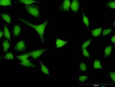 Immunocytochemistry/Immunofluorescence: DPF2 Antibody [H00005977-B02P] - Analysis of purified antibody to DPF2 on HeLa cell. (antibody concentration 20 ug/ml)