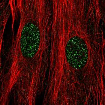 Immunocytochemistry/Immunofluorescence: DPF3 Antibody [NBP2-57317] - Staining of human cell line BJ shows localization to nucleoplasm.
