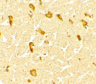 Immunohistochemistry: DPF3 Antibody [NBP2-82087] - Immunohistochemistry of DPF3 in human brain tissue with DPF3 antibody at 5 ug/mL.