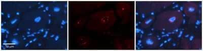 Immunohistochemistry-Paraffin: DPF3 Antibody [NBP2-87298] - Formalin Fixed Paraffin Embedded Tissue: Human Adult heart. Observed Staining: Nuclear. Primary Antibody Concentration: 1:600. Secondary Antibody: Donkey anti-Rabbit-Cy2/3.