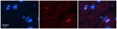 Immunohistochemistry-Paraffin: DPF3 Antibody [NBP2-87299] - Formalin Fixed Paraffin Embedded Tissue: Human Adult heart. Observed Staining: Nuclear (not in cardiomyocytes but in fibrocytes in endomysium. Primary Antibody Concentration: 1:600.