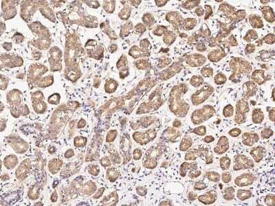 Immunohistochemistry-Paraffin: DPF3 Antibody [NBP2-99185] - Immunochemical staining of human DPF3 in human breast with rabbit polyclonal antibody (1:1000, formalin-fixed paraffin embedded sections).