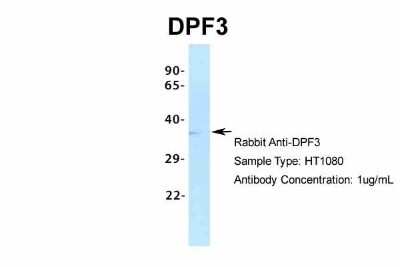 Western Blot: DPF3 Antibody [NBP2-87297] - Host: Rabbit. Target Name: DPF3. Sample Type: HT1080. Antibody Dilution: 1.0ug/ml