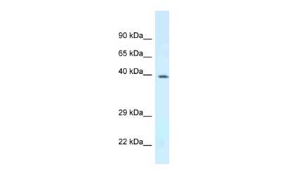 Western Blot: DPF3 Antibody [NBP2-87299] - Titration: 1.0 ug/ml. Positive Control: Mouse Spleen