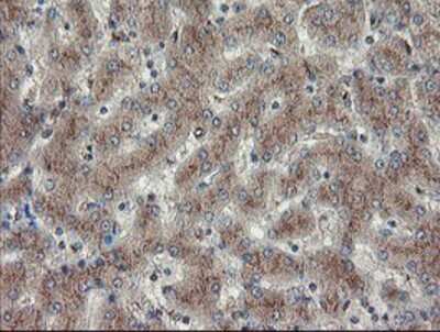 Immunohistochemistry-Paraffin: DPH2 Antibody (4E7) [NBP2-03732] - Staining of paraffin-embedded Human liver tissue using anti-DPH2 mouse monoclonal antibody.