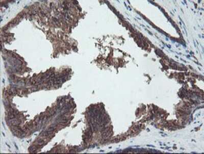 Immunohistochemistry-Paraffin: DPH2 Antibody (4E7) [NBP2-03732] - Staining of paraffin-embedded Human prostate tissue using anti-DPH2 mouse monoclonal antibody.