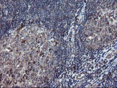 Immunohistochemistry-Paraffin: DPH2 Antibody (4E7) [NBP2-03732] - Staining of paraffin-embedded Human tonsil using anti-DPH2 mouse monoclonal antibody.