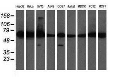 Western Blot: DPH2 Antibody (4E7) [NBP2-03732] Analysis of extracts (35ug) from 9 different cell lines by using anti-DPH2 monoclonal antibody (HepG2: human; HeLa: human; SVT2: mouse; A549: human; COS7: monkey; Jurkat: human; MDCK: canine; PC12: rat; MCF7: human).