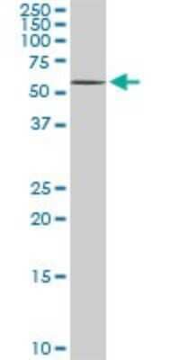 Western Blot: DPH2 Antibody (5B10) [H00001802-M02] - DPH2 monoclonal antibody (M02), clone 5B10. Analysis of DPH2 expression in PC-12.