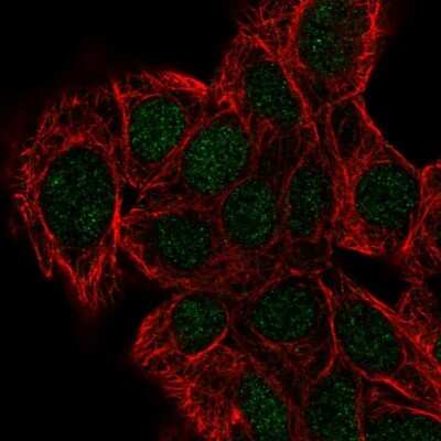 Immunocytochemistry/Immunofluorescence: DPH2 Antibody [NBP2-13933] - Immunofluorescent staining of human cell line Hep G2 shows localization to nucleus.