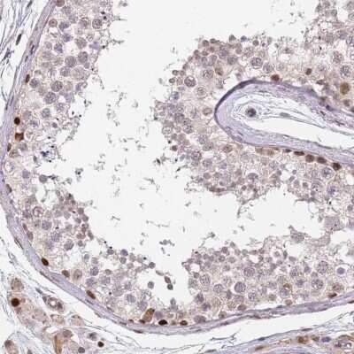 Immunohistochemistry-Paraffin: DPH2 Antibody [NBP2-13933] - Staining of human testis shows strong nuclear positivity in Leydig cells and subset of cells in seminiferous ducts.