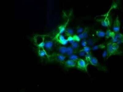 Immunocytochemistry/Immunofluorescence: DPH2 Antibody (OTI3A12) - Azide and BSA Free [NBP2-70587] - Analysis of COS7 cells transiently transfected by pCMV6-ENTRY DPH2.