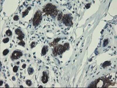 Immunohistochemistry: DPH2 Antibody (OTI3A12) - Azide and BSA Free [NBP2-70587] - Analysis of Human breast tissue.