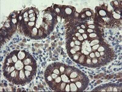 Immunohistochemistry: DPH2 Antibody (OTI3A12) - Azide and BSA Free [NBP2-70587] - Analysis of Human colon tissue..