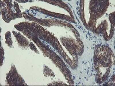 Immunohistochemistry: DPH2 Antibody (OTI3A12) - Azide and BSA Free [NBP2-70587] - Analysis of Human prostate tissue.
