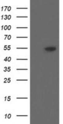 Western Blot: DPH2 Antibody (OTI3A12) - Azide and BSA Free [NBP2-70587] - Analysis of HEK293T cells were transfected with the pCMV6-ENTRY control (Left lane) or pCMV6-ENTRY DPH2 .