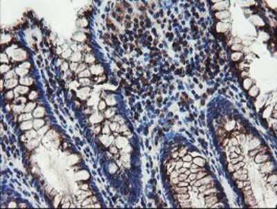 Immunohistochemistry: DPH2 Antibody (OTI4E7) - Azide and BSA Free [NBP2-70585] - Staining of paraffin-embedded Human colon tissue using anti-DPH2 mouse monoclonal antibody.