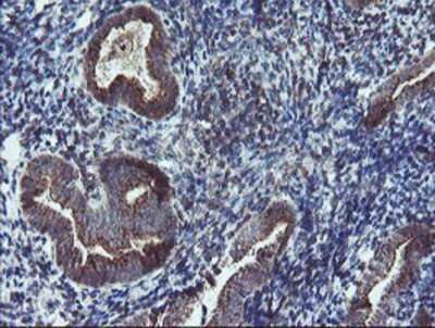 Immunohistochemistry: DPH2 Antibody (OTI4E7) - Azide and BSA Free [NBP2-70585] - Staining of paraffin-embedded Human endometrium tissue using anti-DPH2 mouse monoclonal antibody.