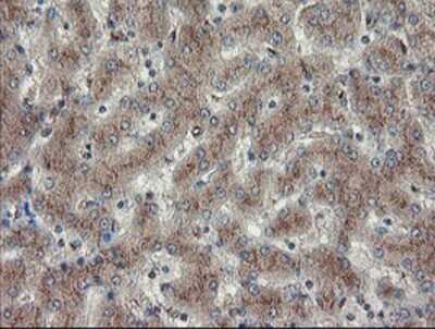 Immunohistochemistry: DPH2 Antibody (OTI4E7) - Azide and BSA Free [NBP2-70585] - Staining of paraffin-embedded Human liver tissue using anti-DPH2 mouse monoclonal antibody.