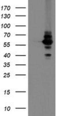 Western Blot DPH2 Antibody (OTI4E7) - Azide and BSA Free