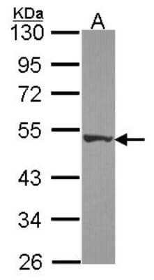 Western Blot: DPH2 Antibody [NBP2-16218] - Sample (30 ug of whole cell lysate) A: Hela 10% SDS PAGE gel, diluted at 1:1000.