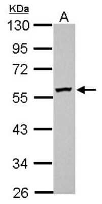 Western Blot: DPH2 Antibody [NBP2-16219] - Sample (30 ug of whole cell lysate) A: HeLa 10% SDS PAGE gel, diluted at 1:1000.