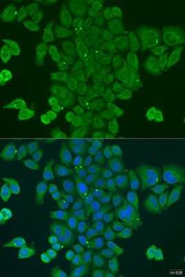 Immunocytochemistry/Immunofluorescence: DPM1 Antibody [NBP2-92678] - Analysis of U2OS cells using DPM1 at dilution of 1:100. Blue: DAPI for nuclear staining.