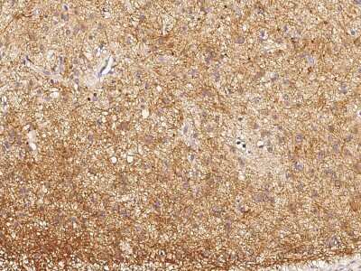 Immunohistochemistry-Paraffin: DPM1 Antibody [NBP2-98802] - Immunochemical staining of human DPM1 in human brain with rabbit polyclonal antibody (1:1000, formalin-fixed paraffin embedded sections).