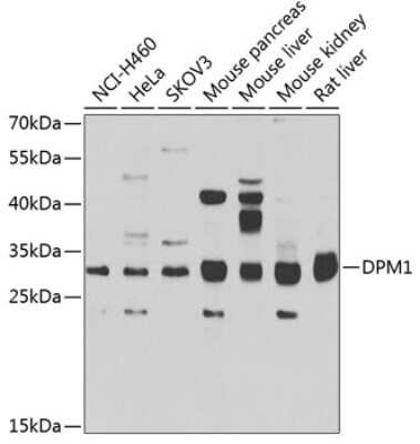 Western Blot: DPM1 Antibody [NBP2-92678] - Analysis of extracts of various cell lines, using DPM1 at 1:1000 dilution.Secondary antibody: HRP Goat Anti-Rabbit IgG (H+L) at 1:10000 dilution.Lysates/proteins: 25ug per lane.Blocking buffer: 3% nonfat dry milk in TBST.Detection: ECL Basic Kit .Exposure time: 90s.