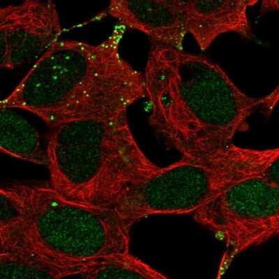 Immunocytochemistry/Immunofluorescence: DPP10 Antibody [NBP2-13936] - Immunofluorescent staining of human cell line SH-SY5Y shows localization to nucleus & vesicles.