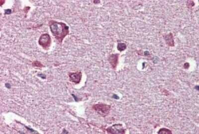 Immunohistochemistry-Paraffin: DPP10 Antibody [NBP1-44338] - Analysis of anti-DPP10 antibody with human brain, cortex.