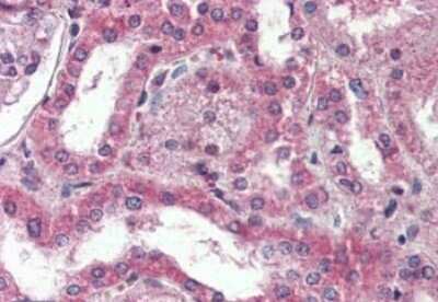 Immunohistochemistry-Paraffin: DPP10 Antibody [NBP1-44338] - Analysis of anti-DPP10 antibody with human kidney.