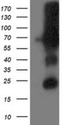 Western Blot: DPP3 Antibody (2D9) [NBP2-01007] - HEK293T cells were transfected with the pCMV6-ENTRY control (Left lane) or pCMV6-ENTRY DPP3 (Right lane) cDNA for 48 hrs and lysed. Equivalent amounts of cell lysates (5 ug per lane) were separated by SDS-PAGE and immunoblotted with anti-DPP3.