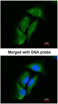 Immunocytochemistry/Immunofluorescence: DPP3 Antibody [NBP1-31476] - Analysis of HeLa, using NBP1-31476 at 1:200 dilution.