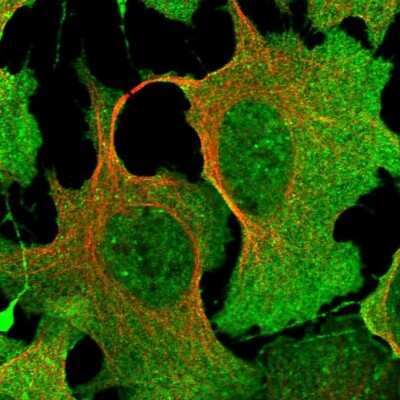 <b>Independent Antibodies Validation. </b>Immunocytochemistry/Immunofluorescence: DPP3 Antibody [NBP1-89493] - Immunofluorescent staining of human cell line U-2 OS shows localization to nuclear speckles, plasma membrane & cytosol.