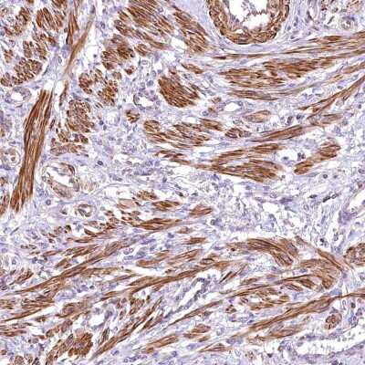 Immunohistochemistry-Paraffin: DPP3 Antibody [NBP2-34021] - Staining of human smooth muscle shows strong cytoplasmic positivity in smooth muscle cells.