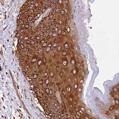 Immunohistochemistry-Paraffin: DPP3 Antibody [NBP1-89493] - Staining of human vulva/anal skin shows strong cytoplasmic positivity in squamous epithelial cells.