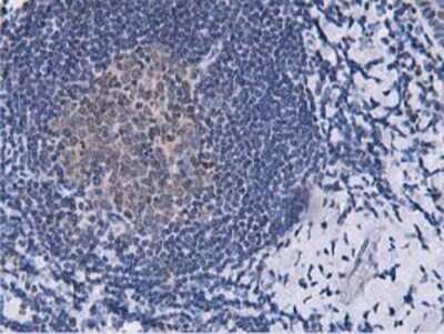 Immunohistochemistry: DPP3 Antibody (OTI2D9) - Azide and BSA Free [NBP2-71541] - Staining of paraffin-embedded Human lymph node tissue using anti-DPP3 mouse monoclonal antibody.