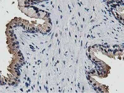 Immunohistochemistry: DPP3 Antibody (OTI2D9) - Azide and BSA Free [NBP2-71541] - Staining of paraffin-embedded Human prostate tissue using anti-DPP3 mouse monoclonal antibody.