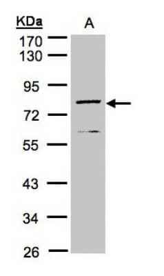 Western Blot: DPP3 Antibody [NBP1-31476] - Sample(30 ug of whole cell lysate) A:MOLT4 10% SDS PAGE, antibody diluted at 1:1000.