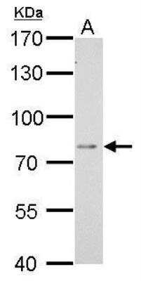 Western Blot: DPP3 Antibody [NBP1-31476] - DPP3 antibody [N2C1], Internal detects DPP3 protein by Western blot analysis. A. 30 ug BCL-1 whole cell lysate/extract. 7.5 % SDS-PAGE. DPP3 antibody [N2C1], Internal  dilution: 1:1000