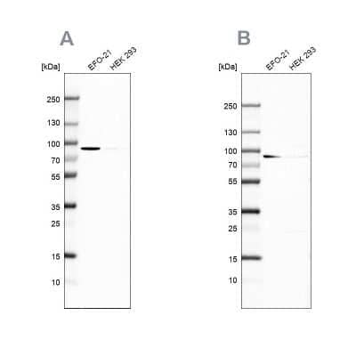 Western Blot: DPP3 Antibody [NBP1-89493] - Analysis using Anti-DPP3 antibody NBP1-89493 (A) shows similar pattern to independent antibody NBP2-34021 (B).