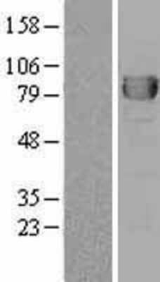 Western Blot: DPP3 Overexpression Lysate (Adult Normal) [NBL1-09996] Left-Empty vector transfected control cell lysate (HEK293 cell lysate); Right -Over-expression Lysate for DPP3.