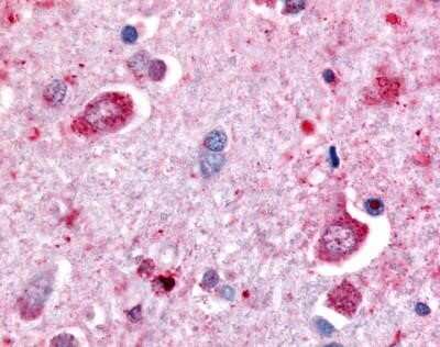 Immunohistochemistry-Paraffin: DPP6 Antibody [NB110-55517] - Analysis of anti-DPP6 antibody with human brain, neurons at 20 ug/ml.