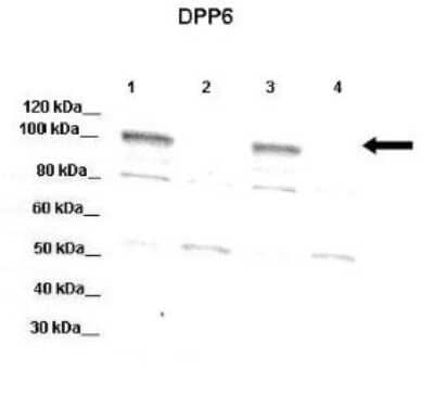 Western Blot: DPP6 Antibody [NBP1-59427] - Lanes: Lane 1: 20 ug mouse WT brain extract Lnae 2: DPP6 -/- mouse brain extract Lane 3: 20 ug mouse WT brain extract 4: DPP6 -/- mouse brain extract Primary Antibody Dilution: 1:1000 Secondary Antibody: Donkey anti-rabbit-HRP Secondary Antibody Dilution: