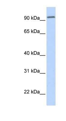 Western Blot: DPP6 Antibody [NBP1-59925] - Human Brain lysate, concentration 0.2-1 ug/ml.