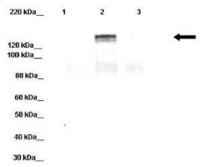 Western Blot: DPP6 Antibody [NBP1-59925] - Lanes: Lane 1 : 20 ug HEK-293 cell lysate Lane 2: 20 ug hDPP6-YFP transfected HEK-293 lysate Lane 3: 20 ug hDPP10-YFP transfected HEK-293 lysate Primary Antibody Dilution: 1 : 1000 Secondary Antibody: Donkey anti-rabbit-HRP Secondary Antibody Dilution: 1 : 10,000 Gene name: DPP6 a Submitted by: Jeanne M. Nerbonne, Arvin Soepriatna, Washington University Medical School Department of Developmental Biology.